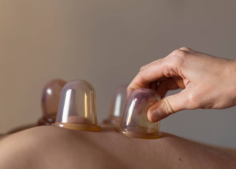 Cupping