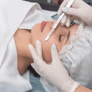 Dermaplaning
