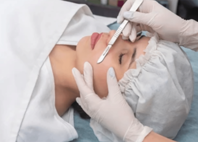 Dermaplaning