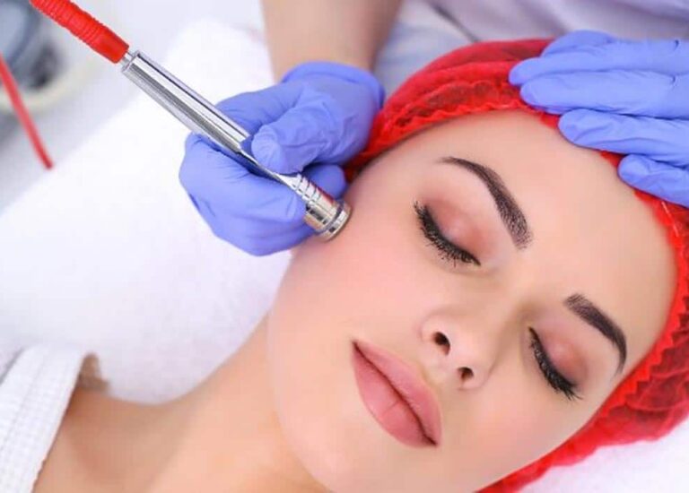 Microdermabrasion